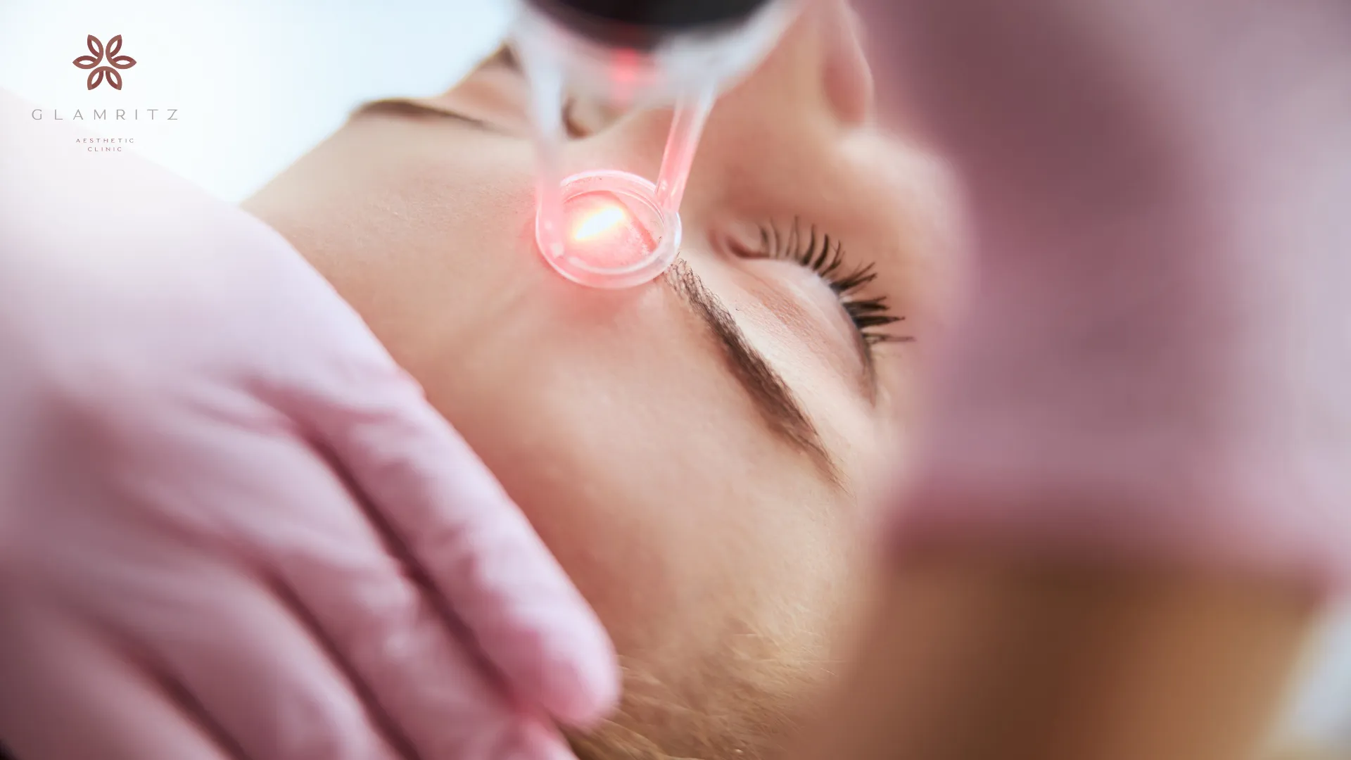 manfaat laser wajah untuk kecantikan