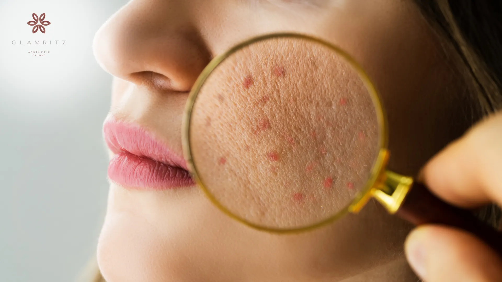 Mengatasi kulit kusam